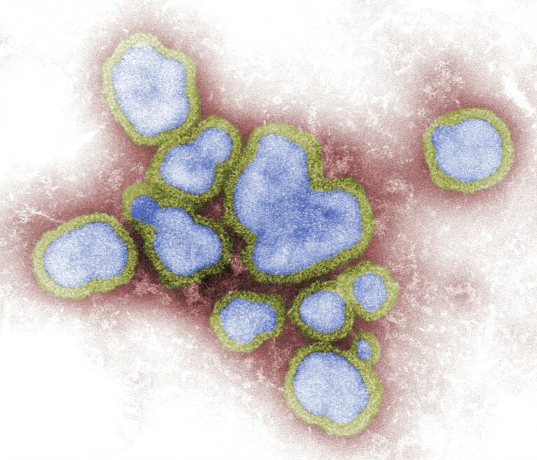 microscopic (TEM) image depicting a number of Influenza A virions